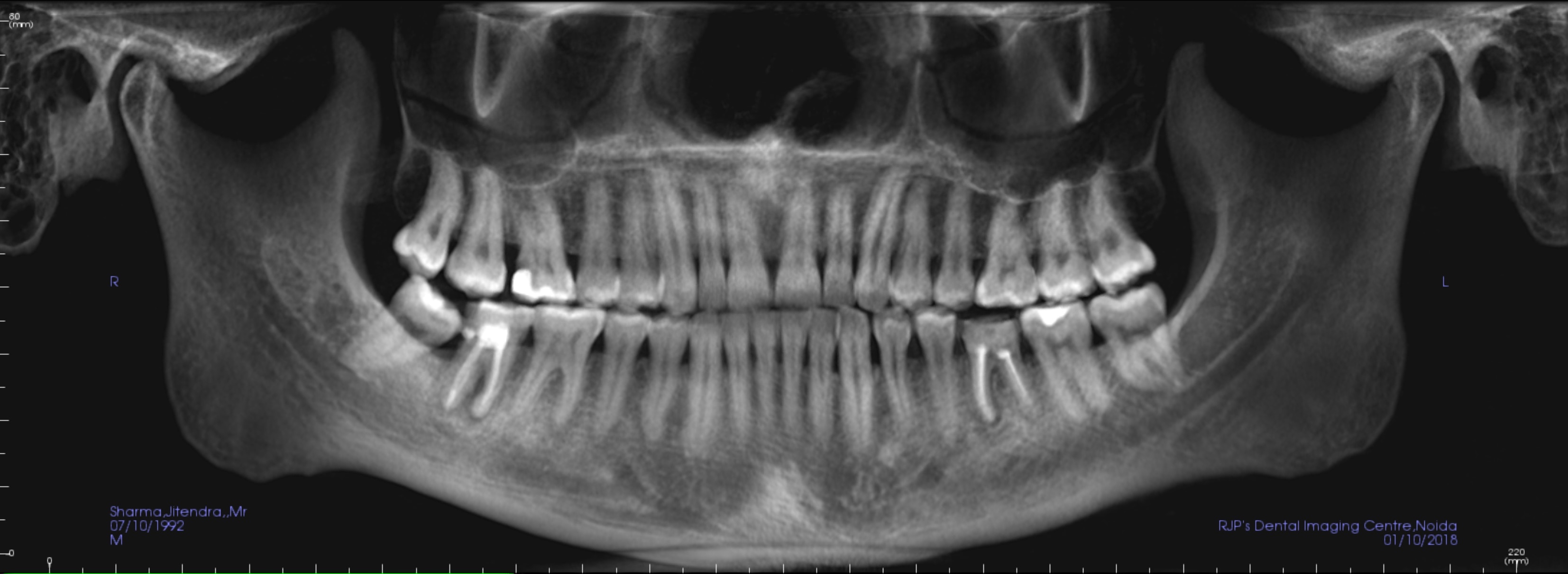 RJP's Dental Imaging Centre in Gautam Buddh Nagar, India