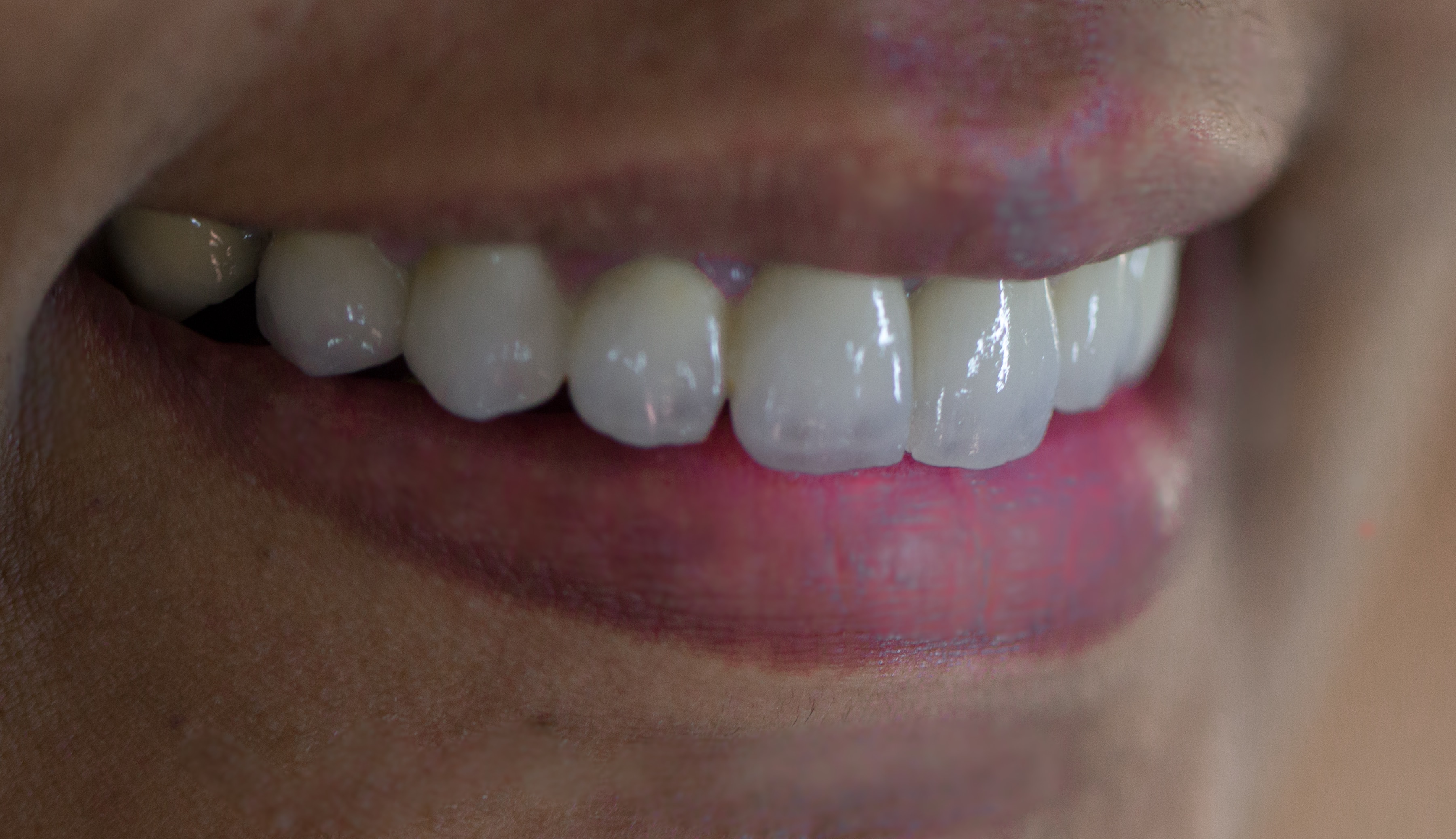 Emmanuel Cosmetic Dental Clinic in Ernakulam, India