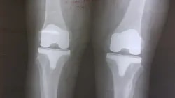 AHA ORTHO CARE