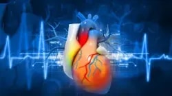 Dr Ashish Khanijo Cardiac Specialist. 08