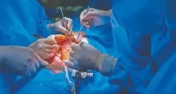 Dr Ashish Khanijo Cardiac Specialist. 08