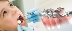 PD Dental Clinic And Implant Centre