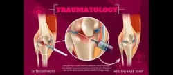 Dr Dhirav Shah- Orthopaedic Surgeon 8104