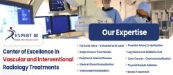 Dr Santosh B. Patil-Best Vascular Specia