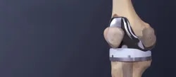 Advance Ortho & Gynaec Center - Orthoped