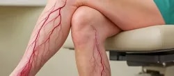 Dr.Abhinav Kesarwani-Varicose Vein Speci