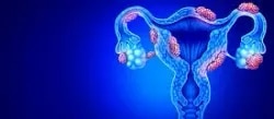 Dr.Kunaal Shinde - Endometriosis Surgeon